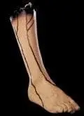 Morris "Severed Right Leg" Bloody Body Part Halloween Prop